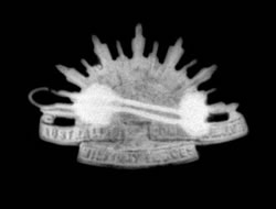 X-ray image of an Australian rising sun cap badge unearthed at Pheasant Wood, Fromelles. 